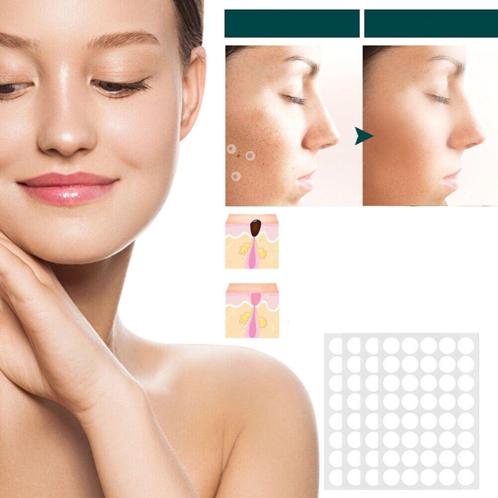 Skin Tag & Wart Removal Patches - Painless Sensitive Treatment