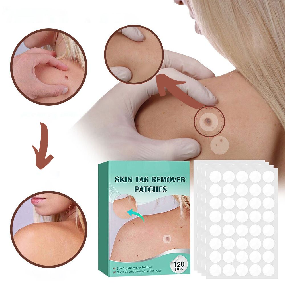 Skin Tag & Wart Removal Patches - Painless Sensitive Treatment